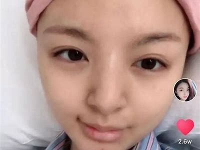 揭秘！为何抖音热潮与其他平台截然不同？